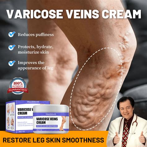 Varicose Veins Remover Treatment Cream Effective Varicose Healing Cream Spider Vein Pain