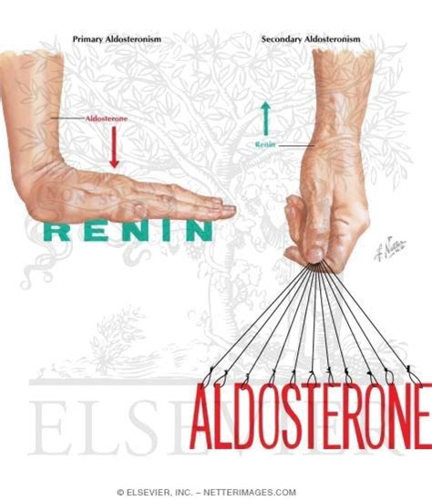 Secondary Aldosteronism