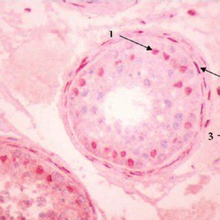 Sections Of Human Adult Testis With Immuno Histochemical Reaction For