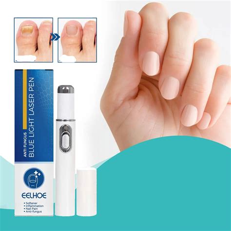 Antifungal Laser Device - Nail Fungus Treatment Pen Anti-fungal Repair