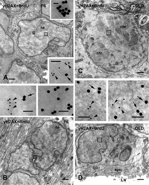 Double Immunogold Labeling For H Ax Nm Gold And Brdu Nm Gold