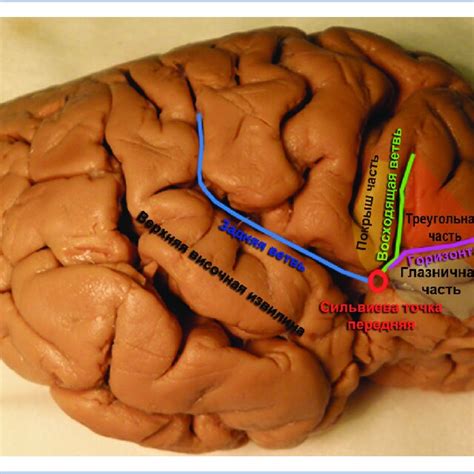 (PDF) [Surgical anatomy of the insular cortex]