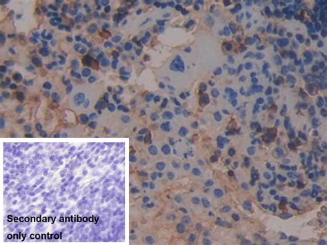 Monoclonal Antibody To Beta 2 Microglobulin B2m Maa260mu24 Mus