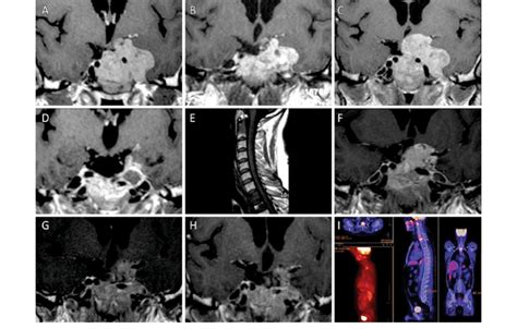 Magnetic resonance imaging (MRI) and positron emission tomography (PET ... 