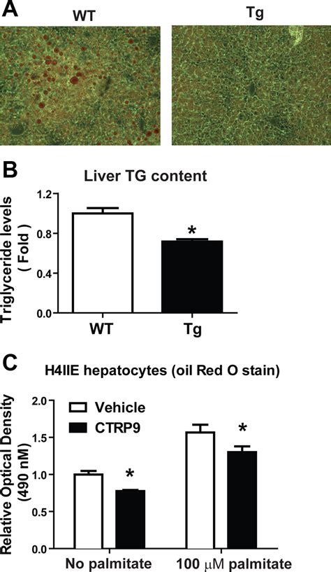 Reduced Hepatic Triglyceride Accumulation In Tg Mice A Representative