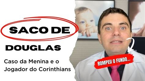 Lacera O Do Fundo De Saco De Douglas Entenda Youtube