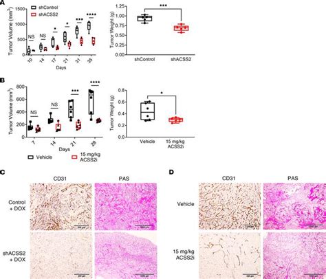 JCI HIF 2α expression and metabolic signaling require ACSS2 in clear