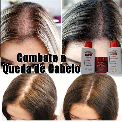 Kit Anti Queda Produtos Para Queda De Cabelo Feminino R Em