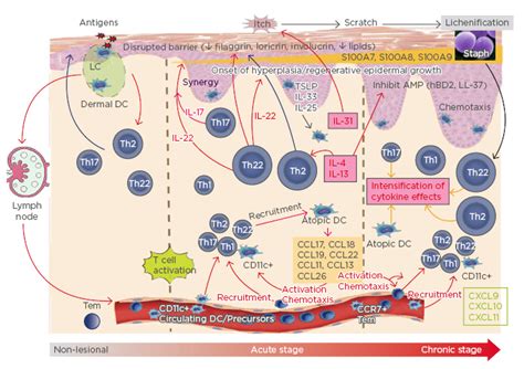 Emj Dermatology On Twitter A Paradigm Shift In The Pathogenesis Of Atopic Dermatitis Read On