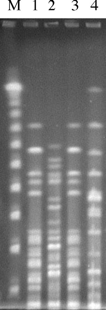 Pfge Profiles Of Spei Digests Of Genomic Dna From Gibbsiella Strains