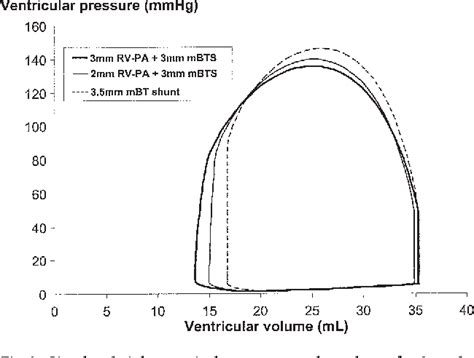 Figure 3 From Management Of A Stenotic Right Ventricle Pulmonary Artery