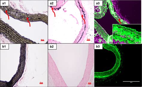 Histology Of The Aortas In Control And Adenine Fed Rats N 6 Per Download Scientific Diagram