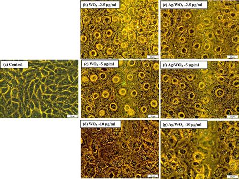 Morphological Changes In Breast Cancer Cells Mcf With A Control