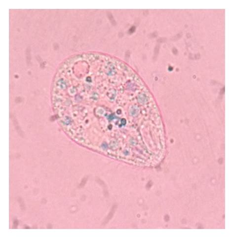 Hookworm Ova A Cyst Of Giardia Lamblia B Oocyst Of Isospora Belli Download Scientific