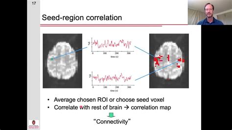 Resting State Functional Connectivity Part 1 Introduction Youtube