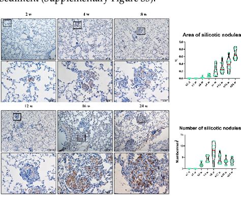 Figure 1 From Minute Cellular Nodules As Early Lesions In Rats With