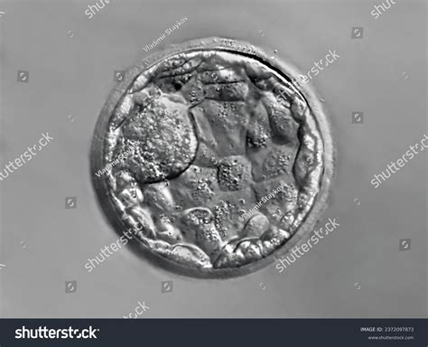 Photomicrograph Isolated Blastocyst Stage Human Embryo Stock Photo ...