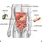 Colorectal Cancer MedlinePlus Medical Encyclopedia