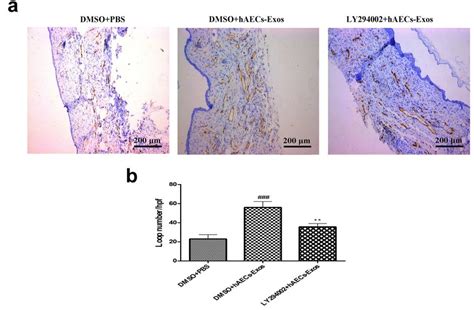 Haecs Exos Increased The Capillary Density In Diabetic Wound Sites A