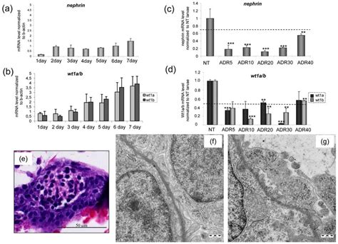 Temporal Expression Pattern Of The Podocyte Markers Nephrin A And