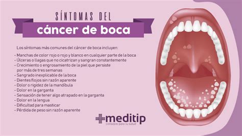 C Ncer De Boca Causas Diagn Stico Y Tratamiento Meditip