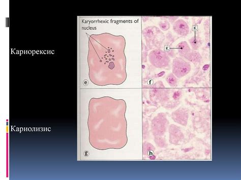 Необратимое повреждение – некроз - online presentation