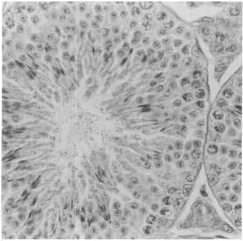 Plate 9 Testis Of A Vehicle Control Male B6c3f1 Mouse Showing No Lesions Hand 450× Niehs