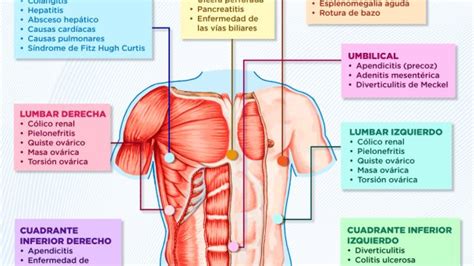 Cuadrantes Del Abdomen Y Dd De Dolor Abdominal