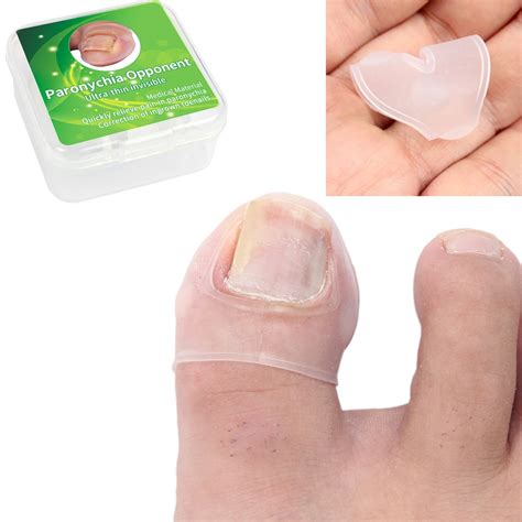 Silicone Ingrown Toenail Correction Tool Invisible Ingrown Toe Nail Treatment Elastic