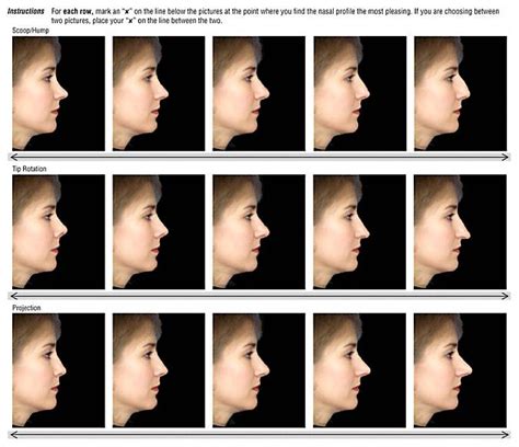 Different Types Of Nose Shapes