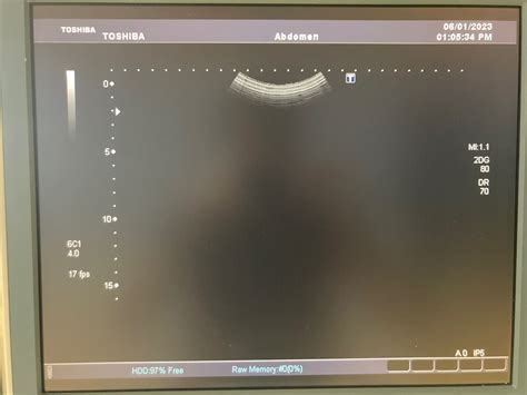 Canon Toshiba Pvt Bt Convex Array Transducer Ultrasound Probe