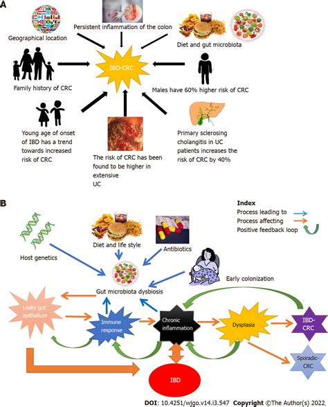 Inflammatory Bowel Disease Related Colorectal Cancer Past Present And