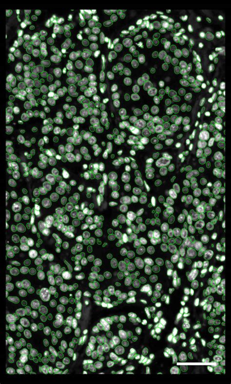 Human Breast Dataset Explorer 10x Genomics