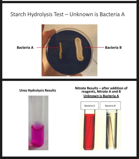 Starch Hydrolysis Test Unknown Is Bacteria A Chegg