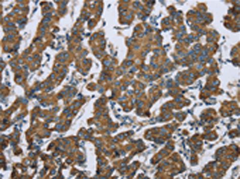 Krt Anti Krt Rabbit Polyclonal Antibody