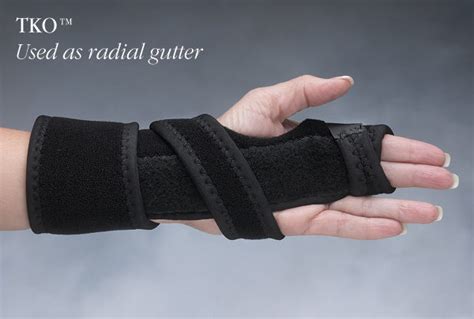 Radial Gutter Splint Pattern