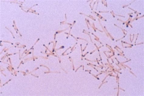 Corynebacterium Gram Stain