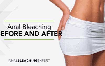 Anal Bleaching DIY Guide On How Anal Bleaching Expert