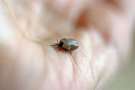 Dog Tick Diseases - Easy Pet Fence