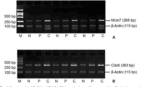 Figure From Expression Of Mcm And Cdc In Oral Squamous Cell