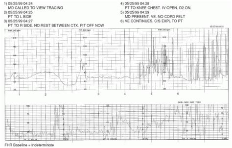 Fetal Heart Rate Pattern Interpretation Obgyn Key