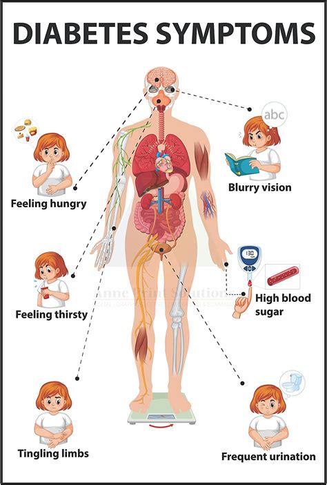 Anne Print Solutions Diabetes Symptoms Poster Without Frame For