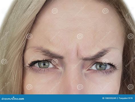 Woman Frowns Her Forehead Wrinkles Botox Stock Image Image Of