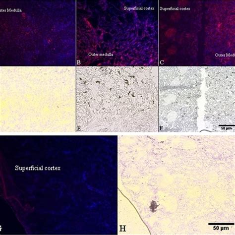 Fluorescent Images Of Kidney Cross Sections Showing Immunolocalisation