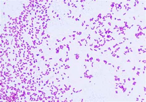 Gram Negative Bacteria Images Photos Of Escherichia Coli Salmonella And Enterobacter