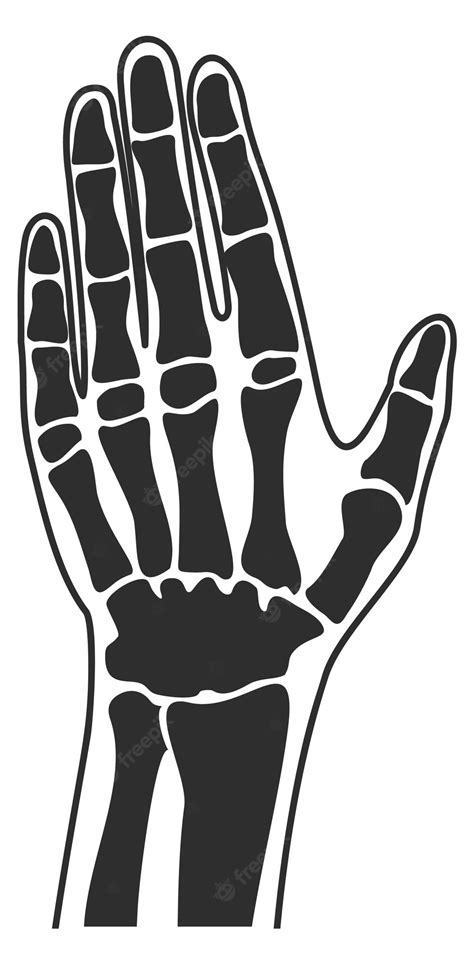 Premium Vector | Human palm xray hand bones anatomy illustration