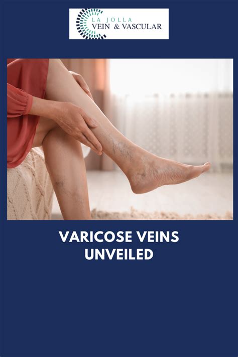 Varicose Veins 101 Causes Symptoms And Relief Options