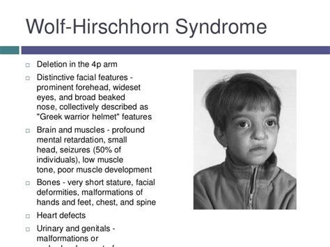 Wolf Hirschhorn Syndrome Adult