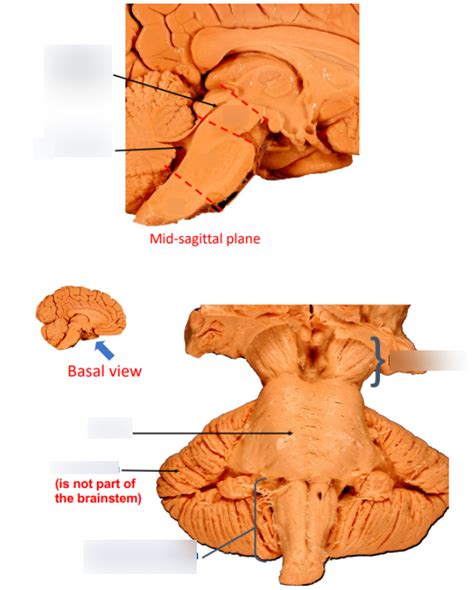 Brainstem Overview Diagram Quizlet