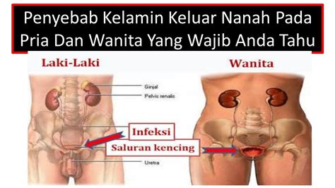 Penyebab Kelamin Keluar Nanah Pada Pria Dan Wanita Yang Wajib Anda Tahu